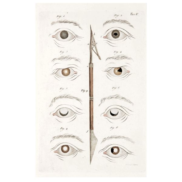 Assalini, Paolo. Ricerche sulle pupille artificiali. Milano, Stamperia Reale Milano, 1811.