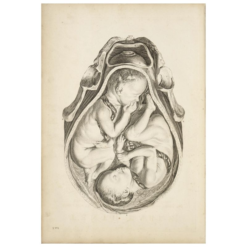 



Prima edizione di questo grande classico di ostetricia che si ritiene sia stato stampato in sole 80-100 copie  - Asta LIBRI, MANOSCRITTI E AUTOGRAFI - Pandolfini Casa d'Aste